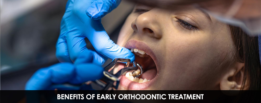 BENEFITS_OF_EARLY_ORTHODONTIC_TREATMENT