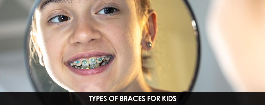 TYPES_OF_BRACES_FOR_KIDS