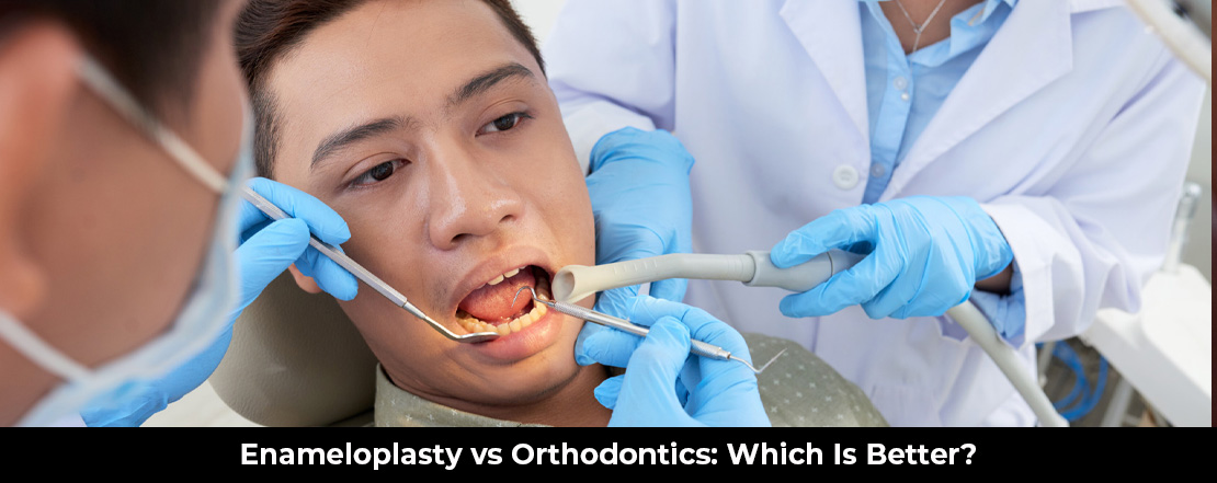 Enameloplasty vs Orthodontics Which Is Better