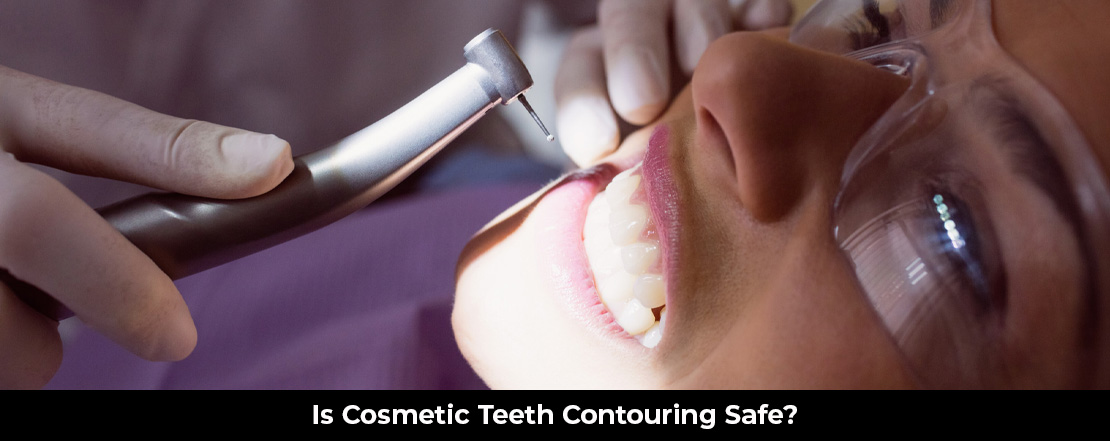Is Cosmetic Teeth Contouring Safe