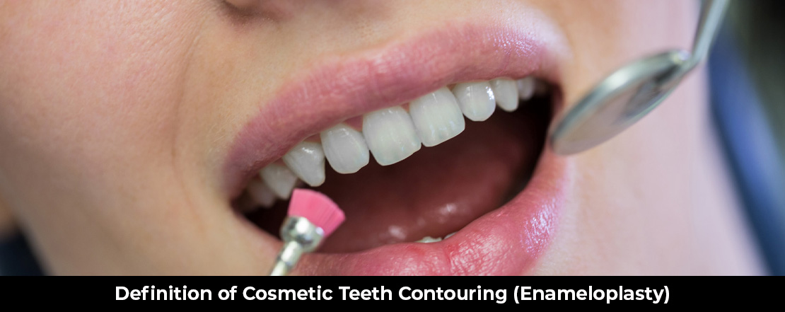 What Is Tooth Contouring (Enameloplasty)