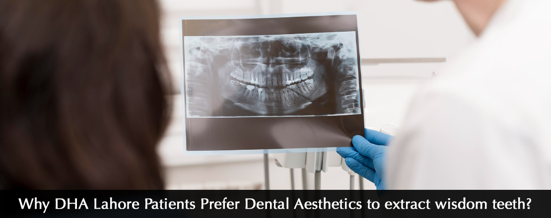 why dha lahore patients prefer dental aesthetics to extract wisdom teeth