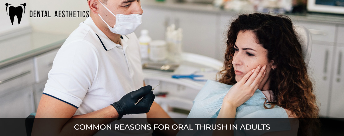 common reasons for oral thrush in adults