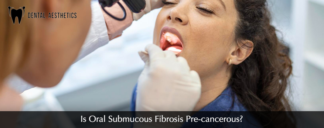 is Oral Submucous Fibrosis Pre-cancerous?