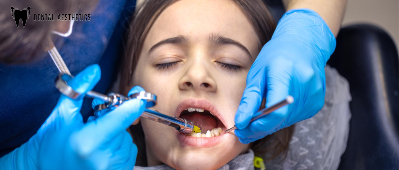 Dental Sealants for Kids in Lahore How to Prevent 80% of Cavities (Cost, Safety & Age Guide)