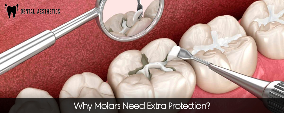 why molars need extra protection