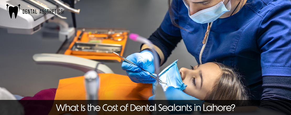 what is the cost of dental sealants in lahore