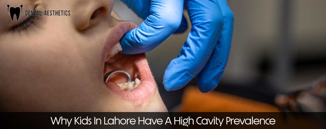 why kids in lahore have a high cavity prevalence