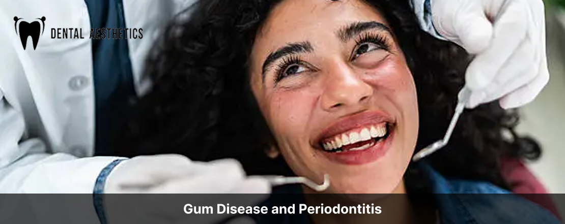 gum disease and periodontitis