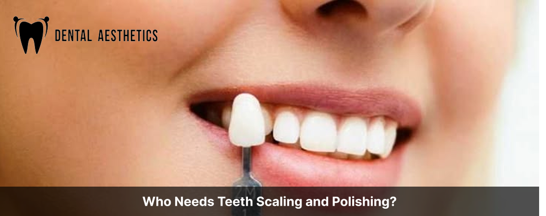 Who Needs Teeth Scaling and Polishing?