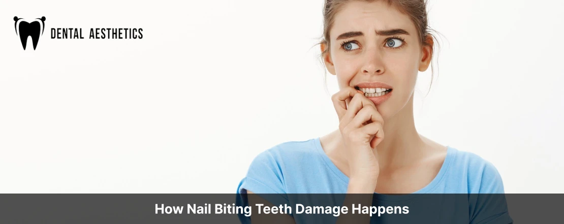 how nail biting teeth damage happens