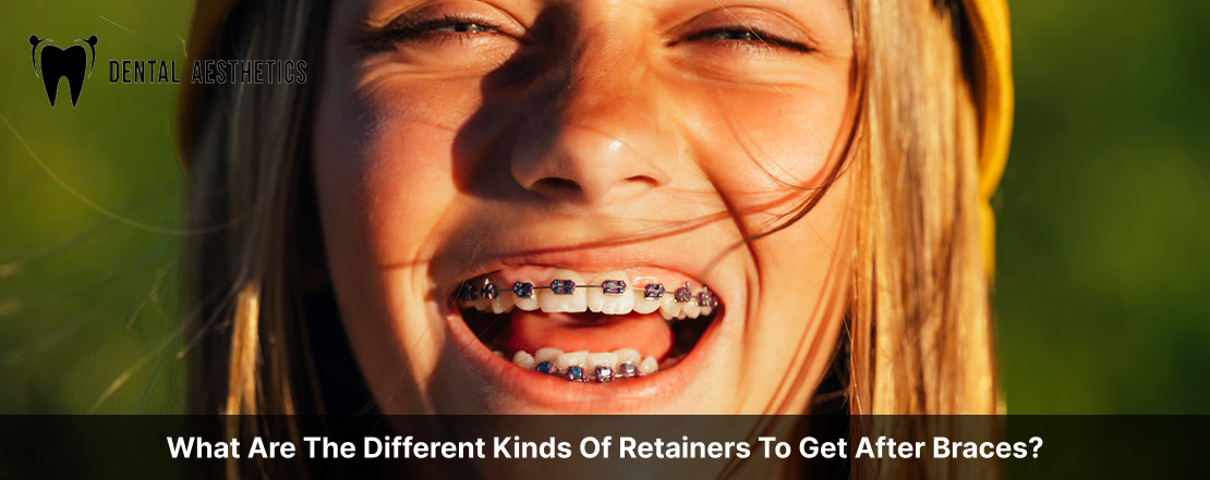 What Are The Different Kinds Of Retainers To Get After Braces?