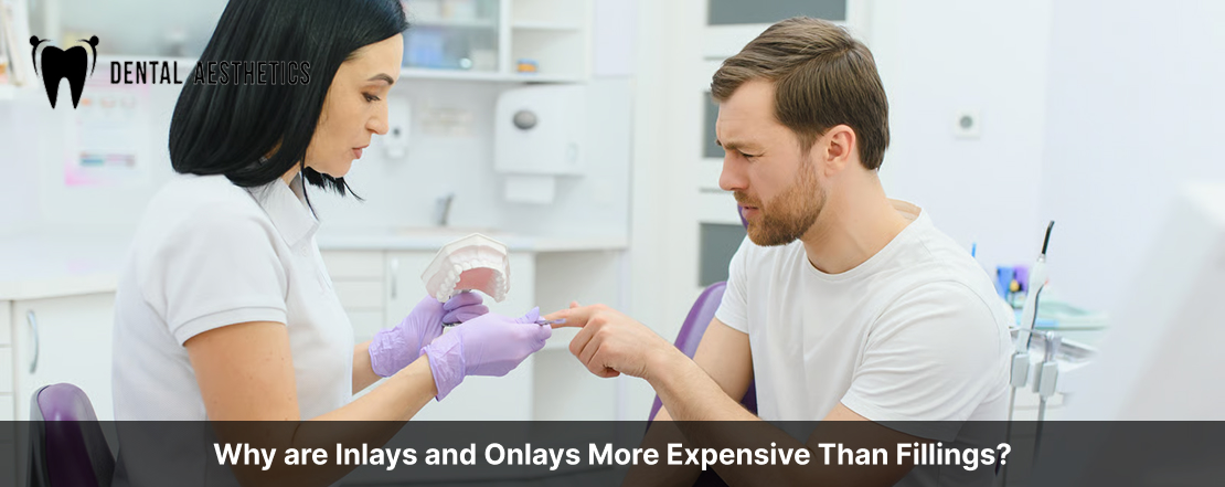 Why are Inlays and Onlays More Expensive Than Fillings?