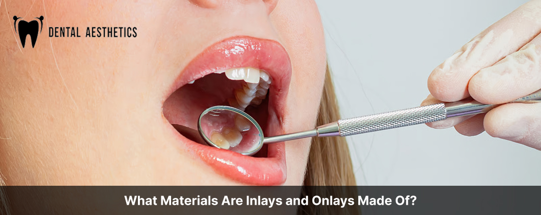 What Materials Are Inlays and Onlays Made Of?