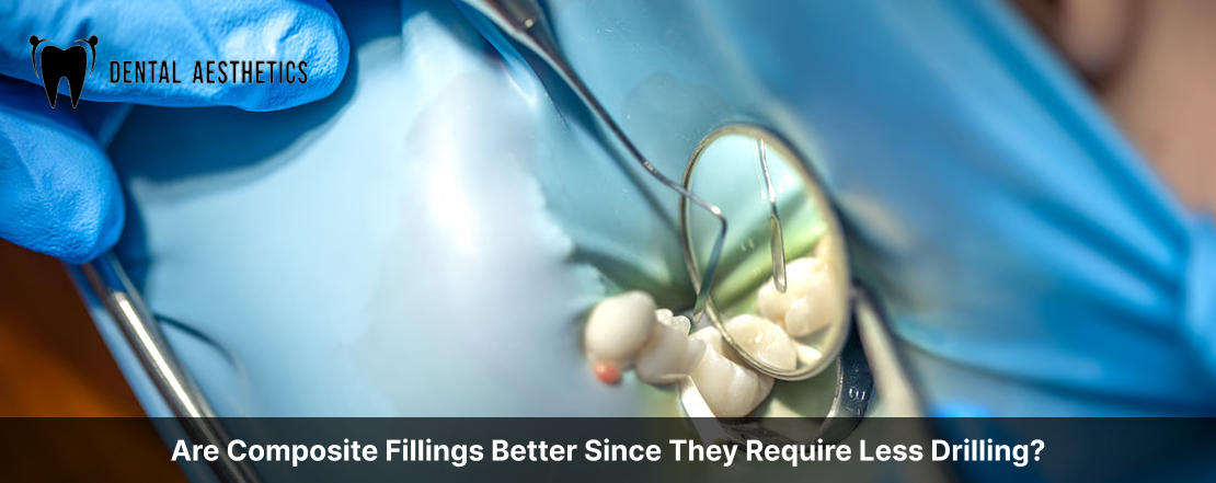 Are Composite Fillings Better Since They Require Less Drilling?