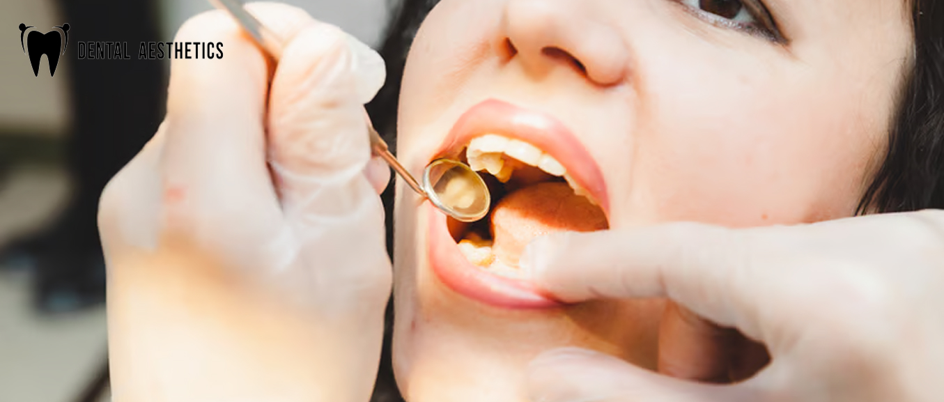 Composite vs Amalgam Fillings: Which Is Better for Your Teeth?