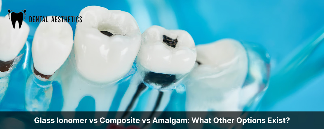 Glass Ionomer vs Composite vs Amalgam: What Other Options Exist?