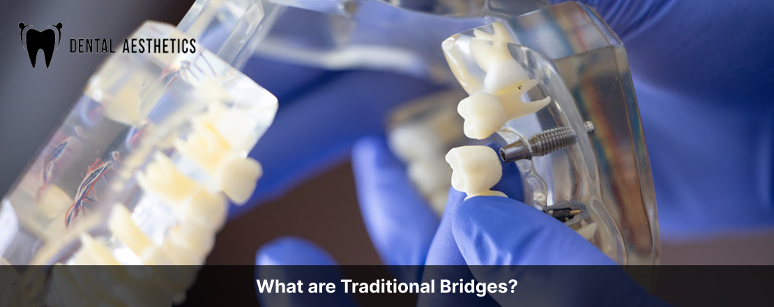 What are Traditional Bridges?
