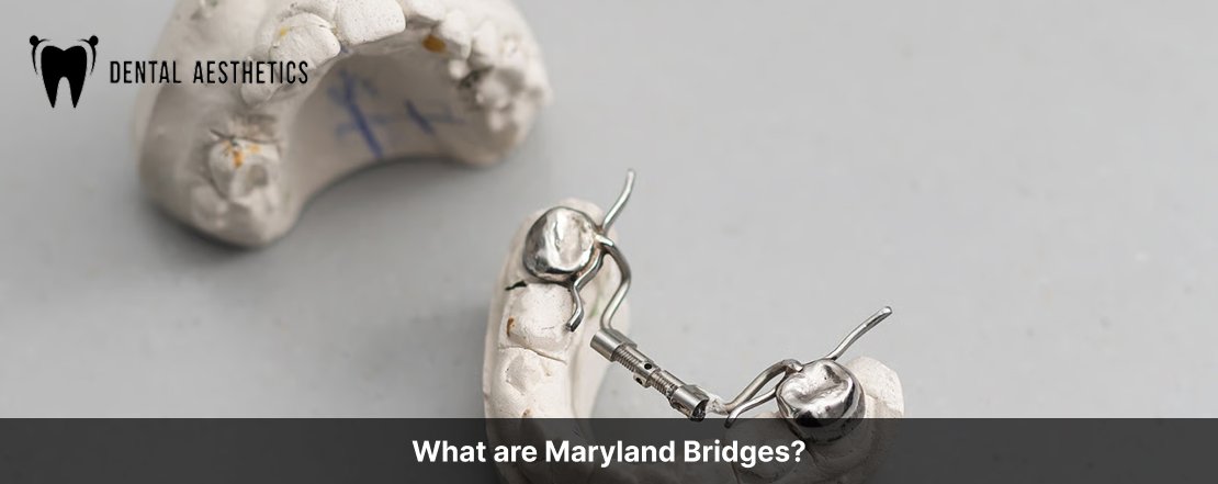 What are Maryland Bridges?