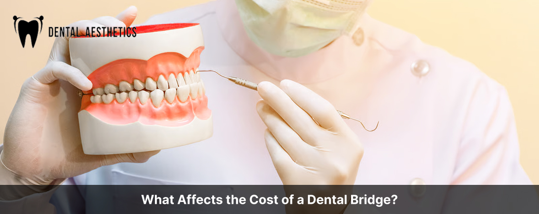 What Affects the Cost of a Dental Bridge?