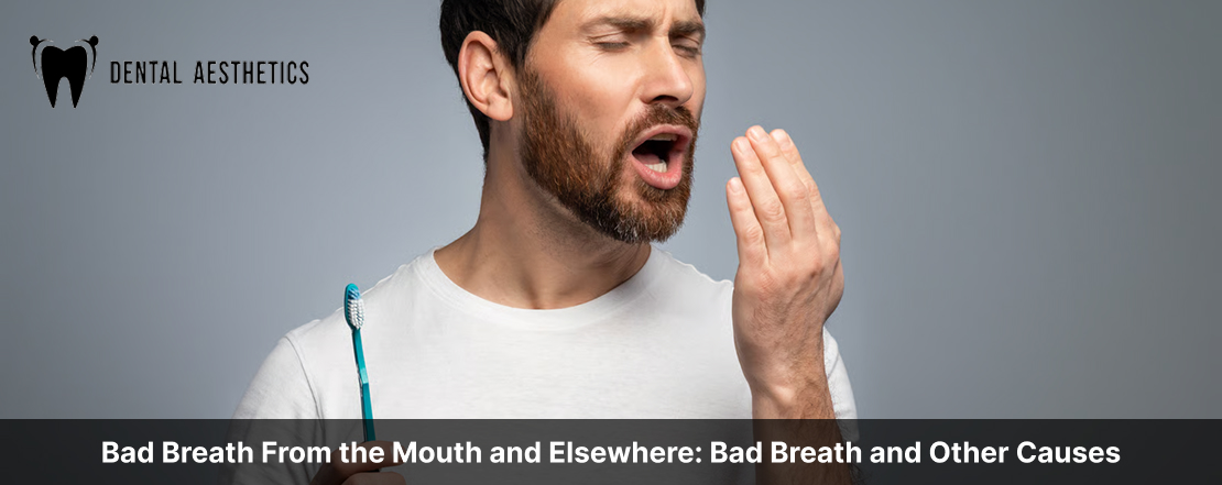 Bad Breath From the Mouth and Elsewhere: Bad Breath and Other Causes