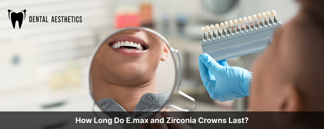 How Long Do E.max and Zirconia Crowns Last?